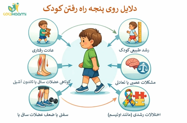 دلایل روی پنجه راه رفتن کودک