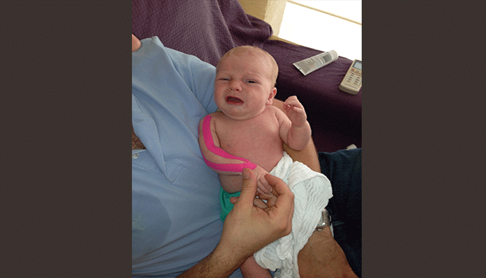 استفاده از کینزیوتیپ