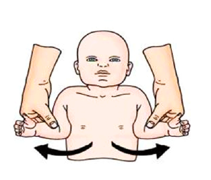 تمرینات کاردرمانی برای فلج ارب